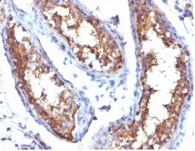 CD99/MIC2 (Ewing's Sarcoma Marker) Antibody in Immunohistochemistry (Paraffin) (IHC (P))