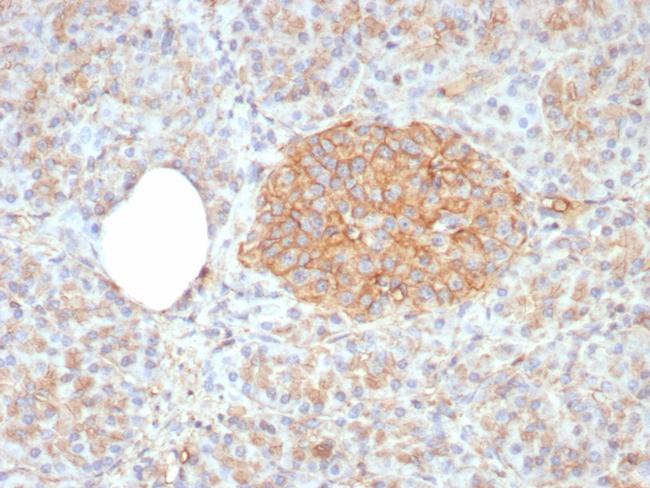 CD99/MIC2 (Ewing's Sarcoma Marker) Antibody in Immunohistochemistry (Paraffin) (IHC (P))