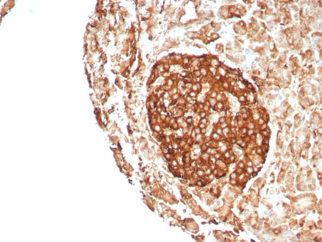 CD99/MIC2 (Ewing's Sarcoma Marker) Antibody in Immunohistochemistry (Paraffin) (IHC (P))