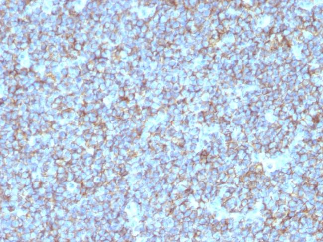 CD99/MIC2 (Ewing's Sarcoma Marker) Antibody in Immunohistochemistry (Paraffin) (IHC (P))