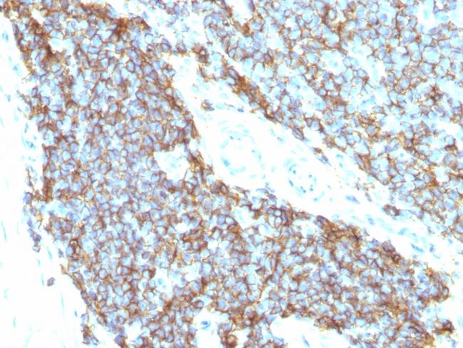 CD99/MIC2 (Ewing's Sarcoma Marker) Antibody in Immunohistochemistry (Paraffin) (IHC (P))