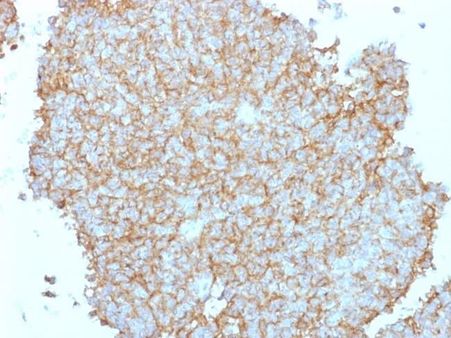 CD99/MIC2 (Ewing's Sarcoma Marker) Antibody in Immunohistochemistry (Paraffin) (IHC (P))