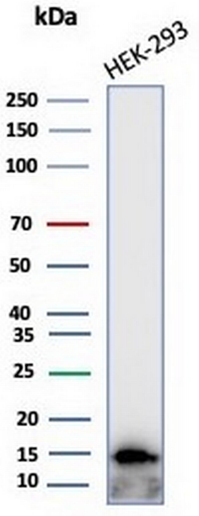 MIF (Macrophage Migration Inhibitory Factor) Antibody in Western Blot (WB)