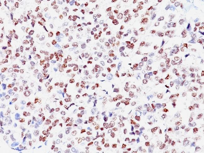 Microphthalmia Transcription Factor (MITF) Antibody in Immunohistochemistry (Paraffin) (IHC (P))