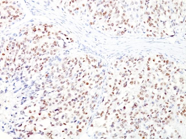 Microphthalmia Transcription Factor (MITF) Antibody in Immunohistochemistry (Paraffin) (IHC (P))