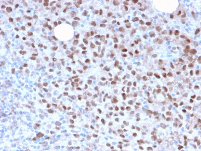 Microphthalmia Transcription Factor (MITF) Antibody in Immunohistochemistry (Paraffin) (IHC (P))