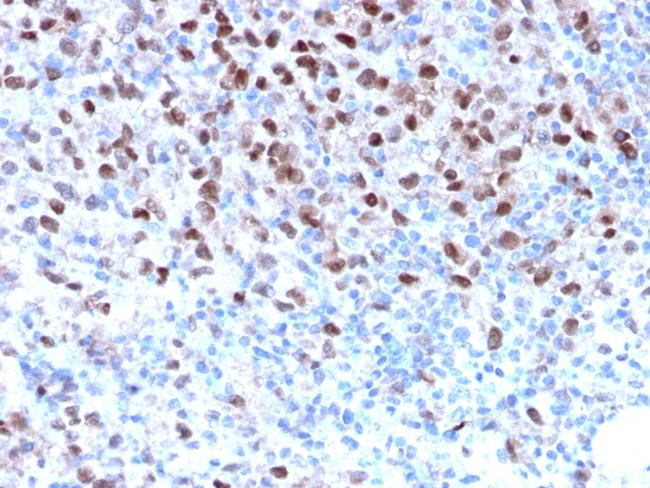 Microphthalmia Transcription Factor (MITF) Antibody in Immunohistochemistry (Paraffin) (IHC (P))