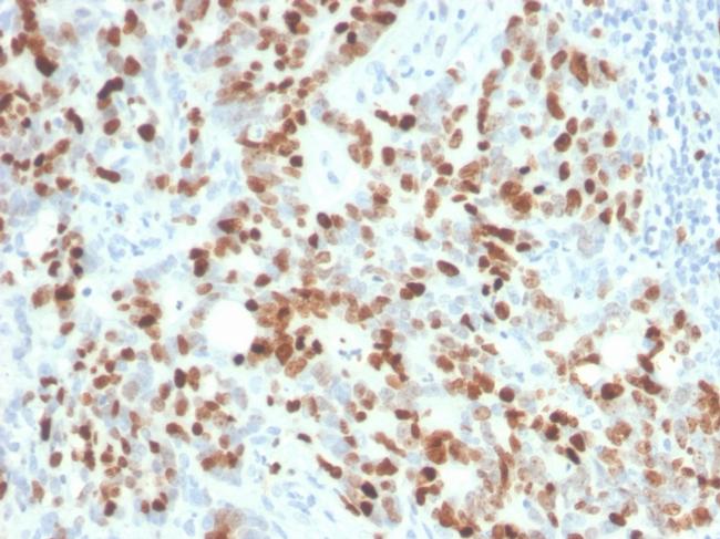 Ki-67 Antibody in Immunohistochemistry (Paraffin) (IHC (P))