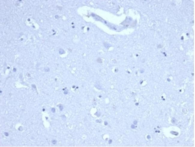 Ki-67 Antibody in Immunohistochemistry (Paraffin) (IHC (P))