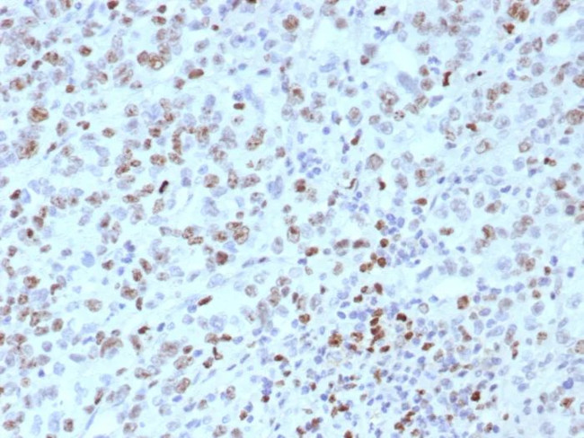 MLH1 (MutL Homolog 1) (Center)/HNPCC Antibody in Immunohistochemistry (Paraffin) (IHC (P))