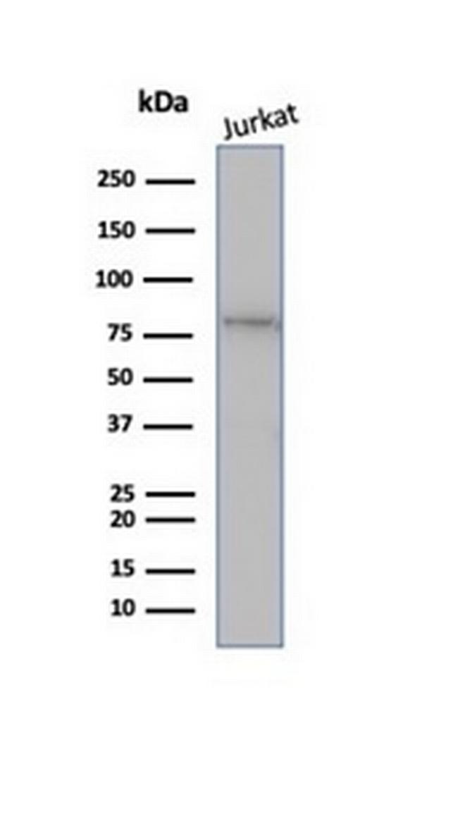 MLH1 (MutL Homolog 1) Antibody in Western Blot (WB)