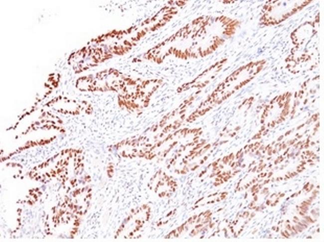 MLH1 (MutL Homolog 1) Antibody in Immunohistochemistry (Paraffin) (IHC (P))