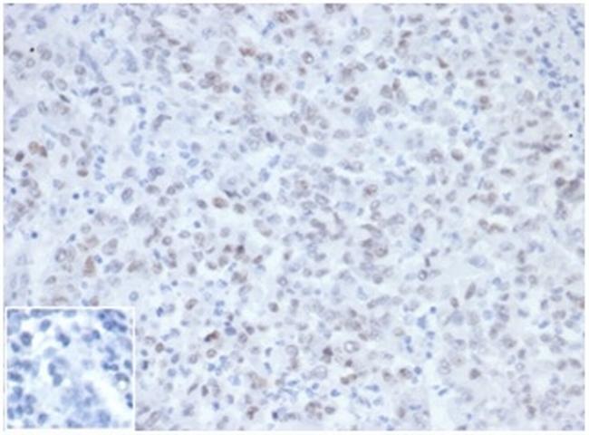 MLH1 (MutL Homolog 1)/HNPCC Antibody in Immunohistochemistry (Paraffin) (IHC (P))