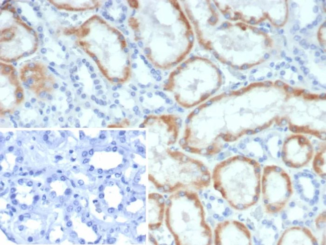 NR3C2/Mineralocorticoid Receptor Antibody in Immunohistochemistry (Paraffin) (IHC (P))