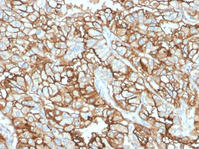 CD10 (Membrane Metalloendopeptidase) Antibody in Immunohistochemistry (Paraffin) (IHC (P))