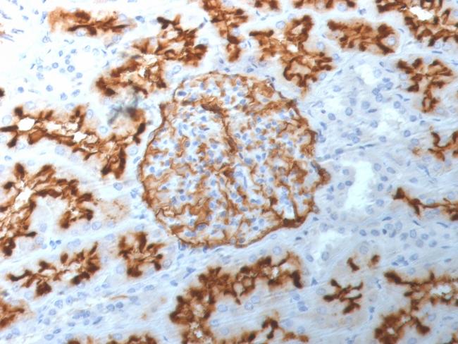 CD10 (Membrane Metalloendopeptidase) Antibody in Immunohistochemistry (Paraffin) (IHC (P))