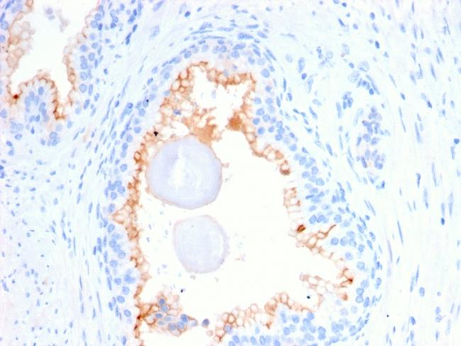 CD10 (Membrane Metalloendopeptidase) Antibody in Immunohistochemistry (Paraffin) (IHC (P))