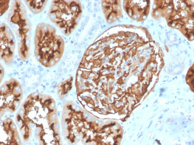 CD10 (Membrane Metalloendopeptidase) Antibody in Immunohistochemistry (Paraffin) (IHC (P))