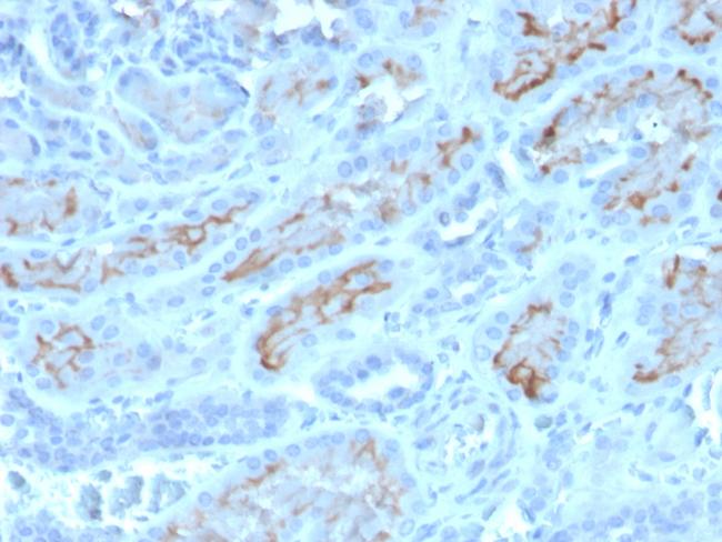 CD10 (Membrane Metalloendopeptidase) Antibody in Immunohistochemistry (Paraffin) (IHC (P))