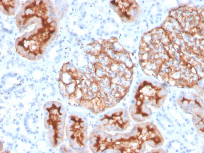 CD10 (Membrane Metalloendopeptidase) Antibody in Immunohistochemistry (Paraffin) (IHC (P))