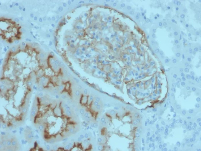 CD10 (Membrane Metalloendopeptidase) Antibody in Immunohistochemistry (Paraffin) (IHC (P))