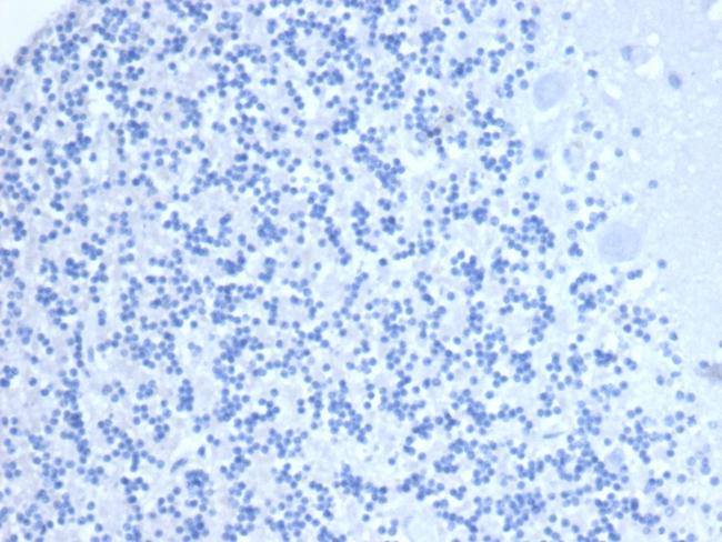 CD10 (Membrane Metalloendopeptidase) Antibody in Immunohistochemistry (Paraffin) (IHC (P))