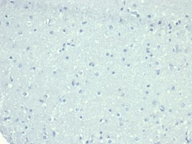 CD10 (Membrane Metalloendopeptidase) Antibody in Immunohistochemistry (Paraffin) (IHC (P))