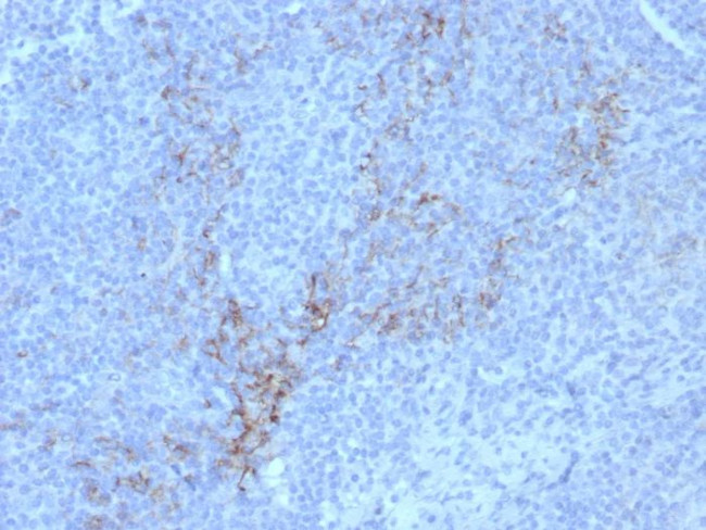 CD10 (Membrane Metalloendopeptidase) Antibody in Immunohistochemistry (Paraffin) (IHC (P))