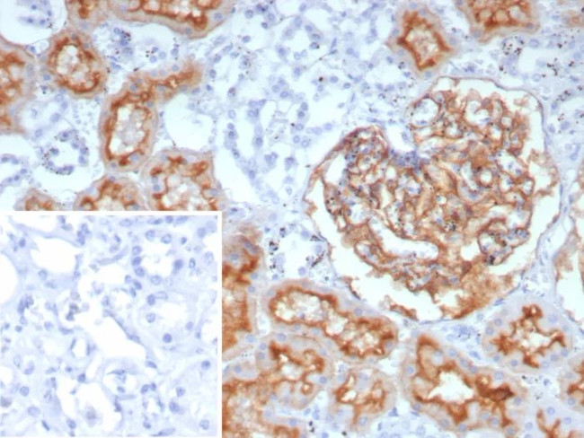 CD10 (Membrane Metalloendopeptidase) Antibody in Immunohistochemistry (Paraffin) (IHC (P))