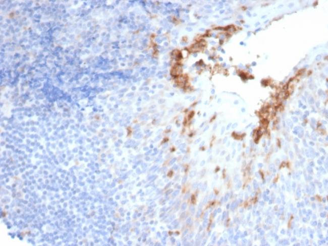 CD10 (Membrane Metalloendopeptidase) Antibody in Immunohistochemistry (Paraffin) (IHC (P))