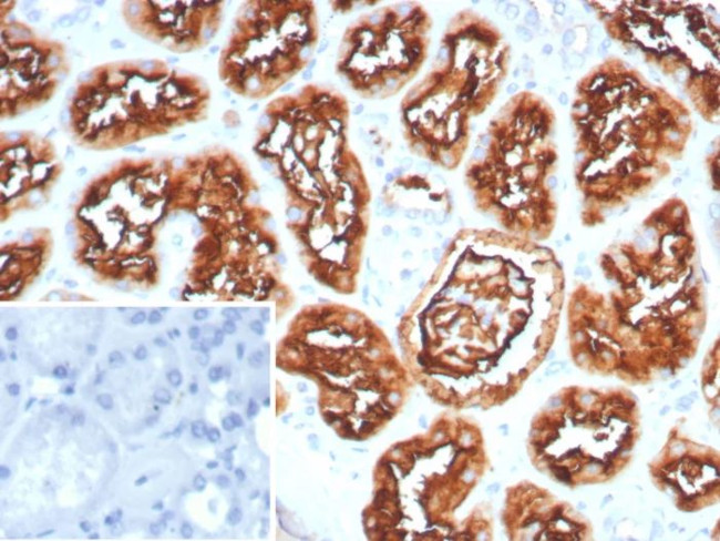 CD10 (Membrane Metalloendopeptidase) Antibody in Immunohistochemistry (Paraffin) (IHC (P))