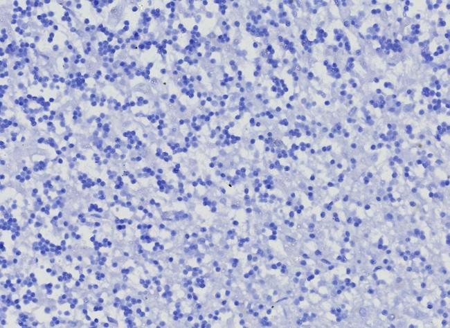 CD10 (Membrane Metalloendopeptidase) Antibody in Immunohistochemistry (Paraffin) (IHC (P))