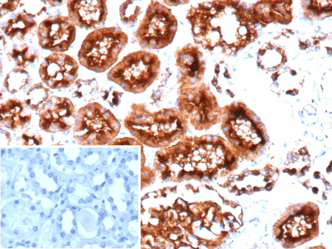 CD10 (Membrane Metalloendopeptidase) Antibody in Immunohistochemistry (Paraffin) (IHC (P))