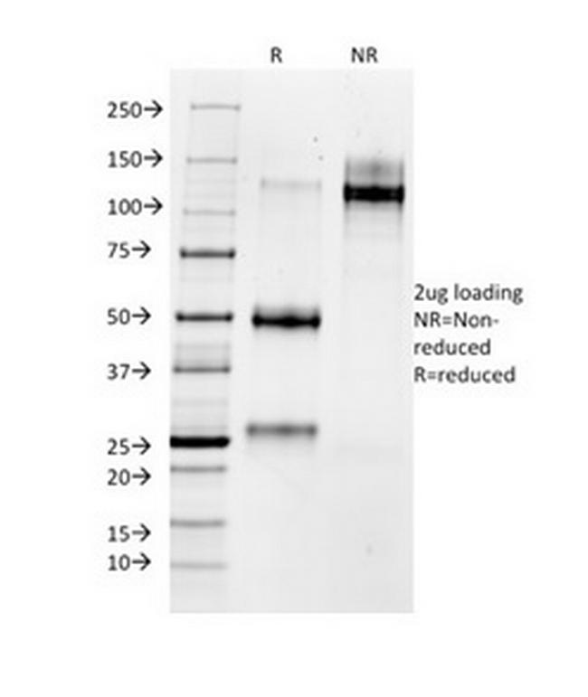 MMP3 (Marker of Metastasis and Rheumatoid Arthritis) Antibody in SDS-PAGE (SDS-PAGE)