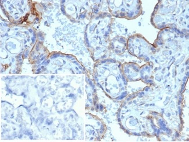 MMP3 (Marker of Metastasis and Rheumatoid Arthritis) Antibody in Immunohistochemistry (Paraffin) (IHC (P))