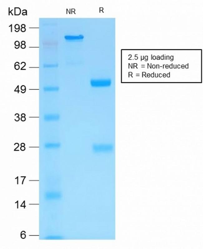 MMP3 (Marker of Metastasis and Rheumatoid Arthritis) Antibody in SDS-PAGE (SDS-PAGE)