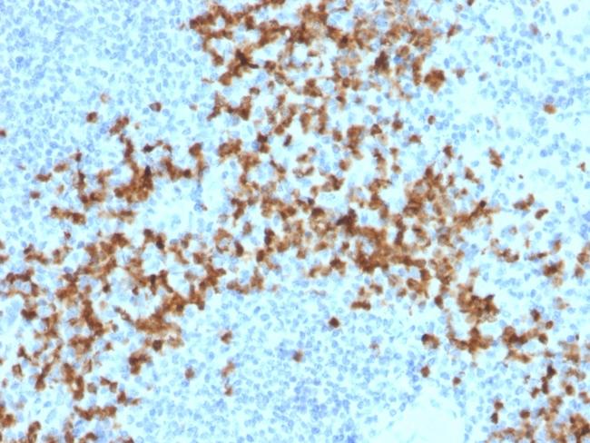 MMP9 (Matrix Metalloproteinase 9) Antibody in Immunohistochemistry (Paraffin) (IHC (P))