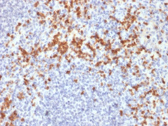 MMP9 (Matrix Metalloproteinase 9) Antibody in Immunohistochemistry (Paraffin) (IHC (P))