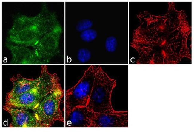 MMP2 Antibody in Immunocytochemistry (ICC/IF)