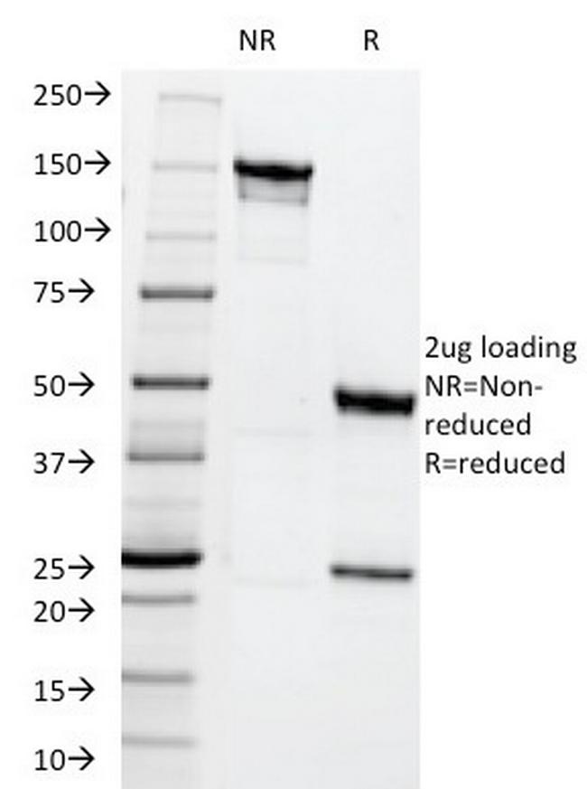 MRP1/ABCC1 (Multidrug Resistance Related Protein 1) Antibody in SDS-PAGE (SDS-PAGE)