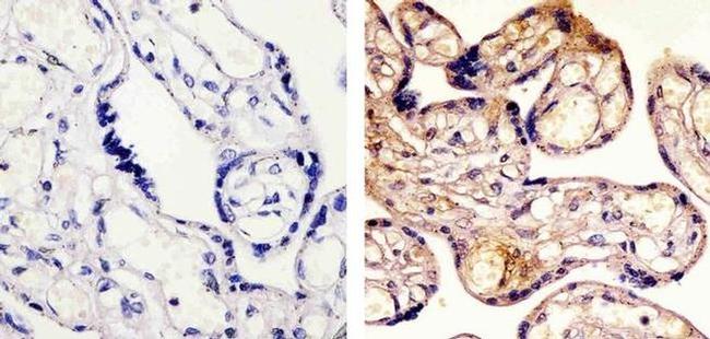 SMAD2 Antibody in Immunohistochemistry (Paraffin) (IHC (P))