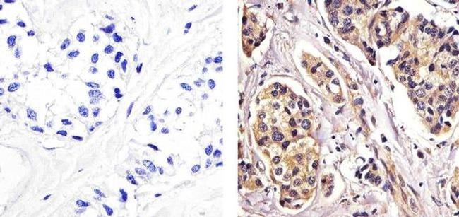 RelB Antibody in Immunohistochemistry (Paraffin) (IHC (P))