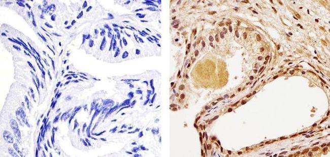 Phospho-PTEN (Thr383) Antibody in Immunohistochemistry (Paraffin) (IHC (P))