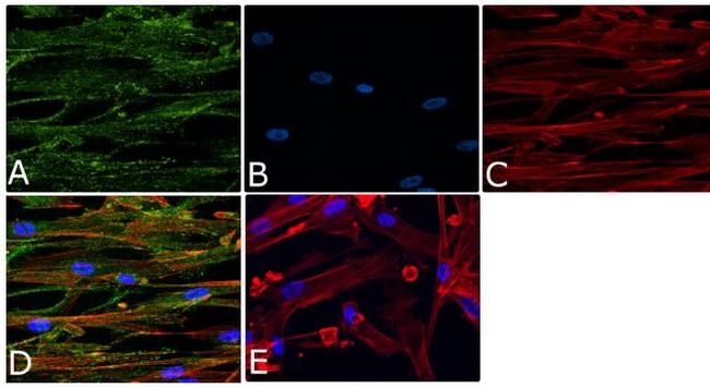 Phospho-Vinculin (Tyr1065) Antibody in Immunocytochemistry (ICC/IF)