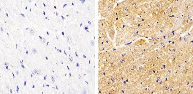 Phospho-Vinculin (Tyr822) Antibody in Immunohistochemistry (Paraffin) (IHC (P))