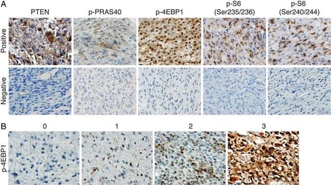 Phospho-PRAS40 (Thr246) Antibody in Immunohistochemistry (IHC)