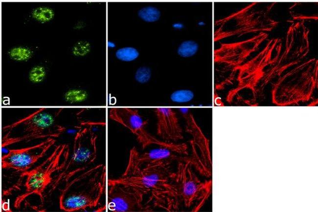 Phospho-ETS2 (Thr72) Antibody in Immunocytochemistry (ICC/IF)