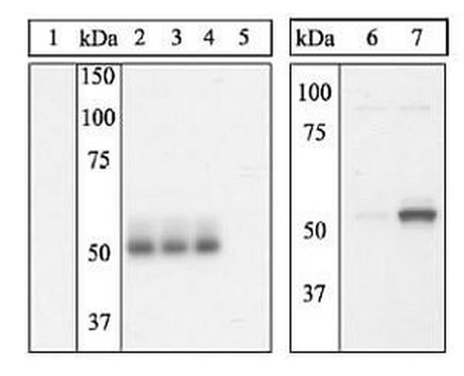 Phospho-ETS1 (Ser251) Antibody in Western Blot (WB)