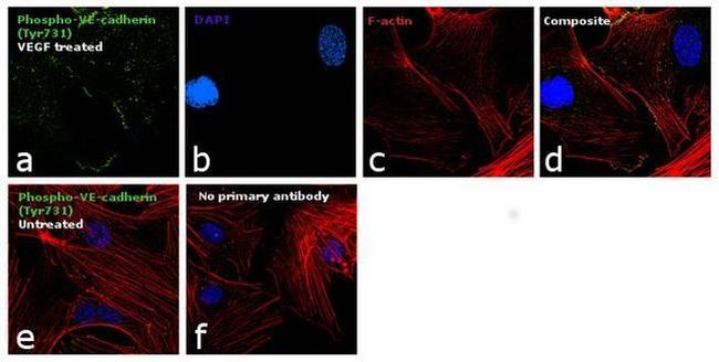 Phospho-VE-cadherin (Tyr731) Antibody in Immunocytochemistry (ICC/IF)