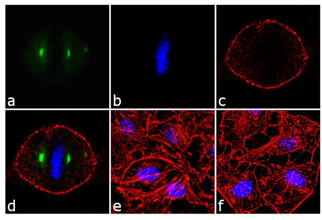 Phospho-Aurora A (Thr288) Antibody in Immunocytochemistry (ICC/IF)